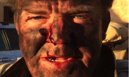 Jeremy Clarkson, Bruised and Battered