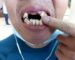 Man Loses Teeth After Being Punched by Grab Driver
