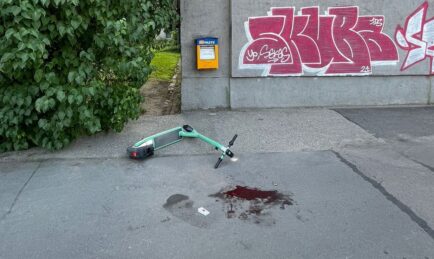 Don’t Drink and Scoot: A Third of Injured Scooter Riders Had Been Drinking