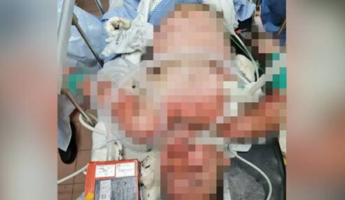 Kereta Dibaiki Masih Rosak. Lelaki Berang Bakar Mekanik